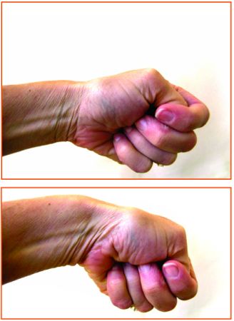 Vanessa Gabrovsky Cu  llar MD Inc | APIC  A2M  Anti-Inflammatory Injections, Whole Body Health   Well-Being and Whole Body Health  Supplements