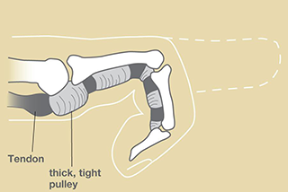 Vanessa Gabrovsky Cu  llar MD Inc | APIC  A2M  Anti-Inflammatory Injections, Whole Body Health  Supplements and Orthopaedic Hand   Wrist Surgery